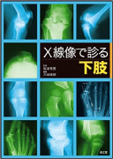 8)X線像で診る下肢